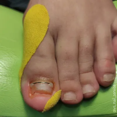 Podolog Lubin - Valentyna Stohnii | Studio Podo & Nails